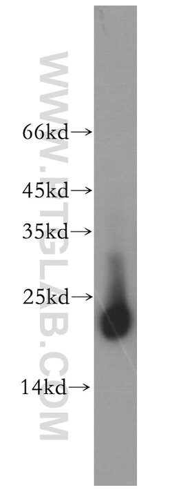 RAC1/2/3 Rabbit anti-Human, Mouse, Rat, Polyclonal, Proteintech:Antibodies:Primary