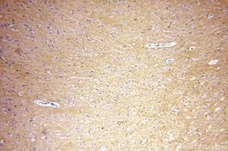 RAC1/2/3 Rabbit anti-Human, Mouse, Rat, Polyclonal, Proteintech:Antibodies:Primary