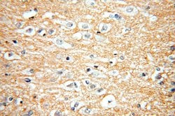 RAC1/2/3 Rabbit anti-Human, Mouse, Rat, Polyclonal, Proteintech:Antibodies:Primary