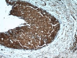 EIF4A2 Rabbit anti-Human, Mouse, Rat, Polyclonal, Proteintech 150 &mu;L;