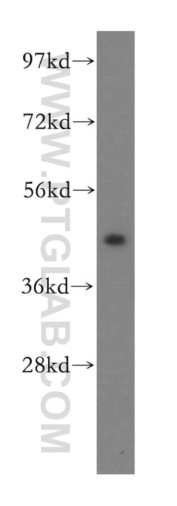 EIF4A2 Rabbit anti-Human, Mouse, Rat, Polyclonal, Proteintech 150 &mu;L;