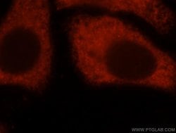 EIF4A2 Rabbit anti-Human, Mouse, Rat, Polyclonal, Proteintech 150 &mu;L;