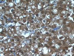 EIF4A2 Rabbit anti-Human, Mouse, Rat, Polyclonal, Proteintech 150 &mu;L;