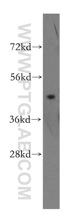 EIF4A2 Rabbit anti-Human, Mouse, Rat, Polyclonal, Proteintech 150 &mu;L;