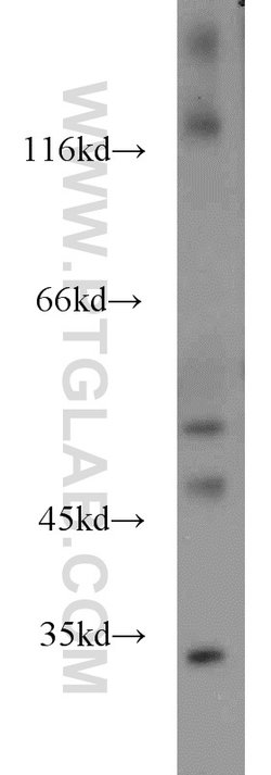 HMBOX1 Rabbit anti-Human, Mouse, Rat, Polyclonal, Proteintech:Antibodies:Primary