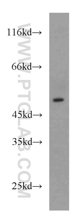 HMBOX1 Rabbit anti-Human, Mouse, Rat, Polyclonal, Proteintech:Antibodies:Primary