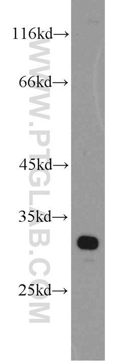 PHYHD1 Rabbit anti-Human, Mouse, Rat, Polyclonal, Proteintech 150 &mu;L;