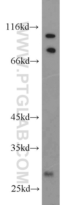 PHYHD1 Rabbit anti-Human, Mouse, Rat, Polyclonal, Proteintech 150 &mu;L;