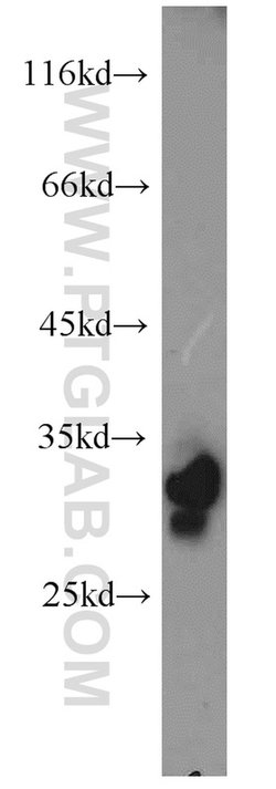 PHYHD1 Rabbit anti-Human, Mouse, Rat, Polyclonal, Proteintech 150 &mu;L;