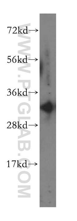 PHYHD1 Rabbit anti-Human, Mouse, Rat, Polyclonal, Proteintech 150 &mu;L;