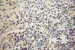 RNASEH2A Rabbit anti-Human, Polyclonal, Proteintech:Antibodies:Primary