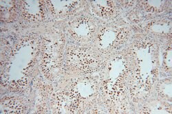RNASEH2A Rabbit anti-Human, Polyclonal, Proteintech:Antibodies:Primary