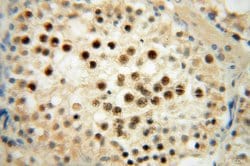 RNASEH2A Rabbit anti-Human, Polyclonal, Proteintech:Antibodies:Primary