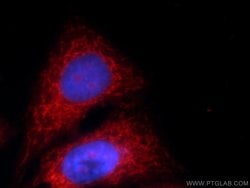 MRPS18B Rabbit anti-Human, Mouse, Rat, Polyclonal, Proteintech 150 &mu;L;