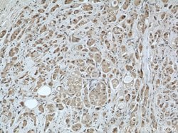 MRPS18B Rabbit anti-Human, Mouse, Rat, Polyclonal, Proteintech 150 &mu;L;