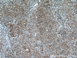 MRPS18B Rabbit anti-Human, Mouse, Rat, Polyclonal, Proteintech 150 &mu;L;