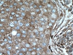 MRPS18B Rabbit anti-Human, Mouse, Rat, Polyclonal, Proteintech 150 &mu;L;