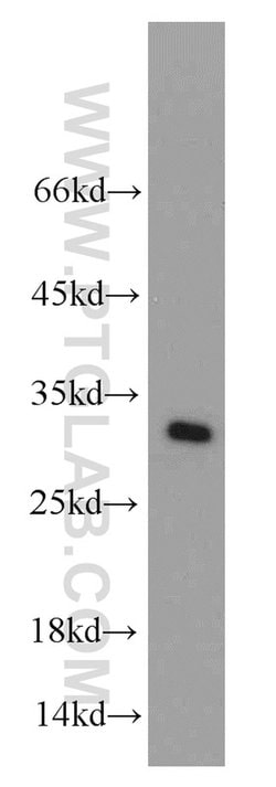 MRPS18B Rabbit anti-Human, Mouse, Rat, Polyclonal, Proteintech 150 &mu;L;