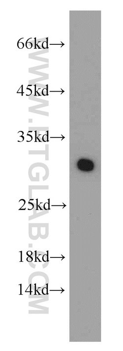 MRPS18B Rabbit anti-Human, Mouse, Rat, Polyclonal, Proteintech 150 &mu;L;