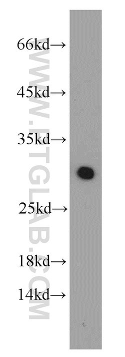 MRPS18B Rabbit anti-Human, Mouse, Rat, Polyclonal, Proteintech 150 &mu;L;