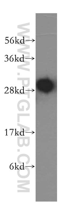 MRPS18B Rabbit anti-Human, Mouse, Rat, Polyclonal, Proteintech 150 &mu;L;