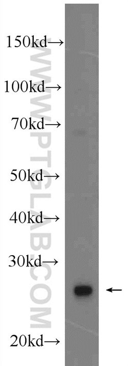 MRPS18B Rabbit anti-Human, Mouse, Rat, Polyclonal, Proteintech 150 &mu;L;