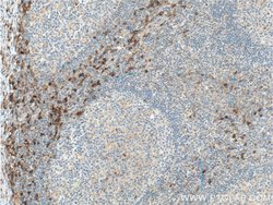 CCR2b Rabbit anti-Human, Polyclonal, Proteintech:Antibodies:Primary Antibodies