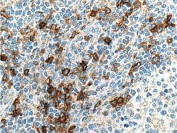 CCR2b Rabbit anti-Human, Polyclonal, Proteintech:Antibodies:Primary Antibodies