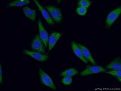 KRAS-2B Rabbit anti-Human, Mouse, Polyclonal, Proteintech 150 &mu;L; Unconjugated:Antibodies,