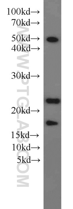 KRAS-2B Rabbit anti-Human, Mouse, Polyclonal, Proteintech 150 &mu;L; Unconjugated:Antibodies,