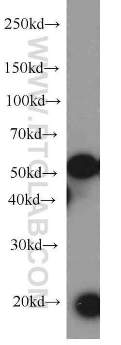 KRAS-2B Rabbit anti-Human, Mouse, Polyclonal, Proteintech 150 &mu;L; Unconjugated:Antibodies,