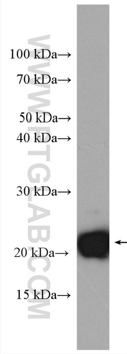 KRAS-2B Rabbit anti-Human, Mouse, Polyclonal, Proteintech 150 &mu;L; Unconjugated:Antibodies,