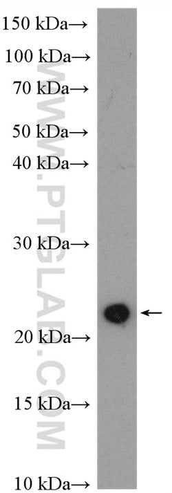 KRAS-2B Rabbit anti-Human, Mouse, Polyclonal, Proteintech 150 &mu;L; Unconjugated:Antibodies,