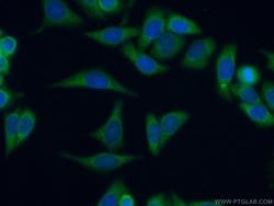 KRAS-2B Rabbit anti-Human, Mouse, Polyclonal, Proteintech 150 &mu;L; Unconjugated:Antibodies,