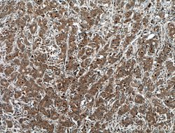 KRAS-2B Rabbit anti-Human, Mouse, Polyclonal, Proteintech 150 &mu;L; Unconjugated:Antibodies,