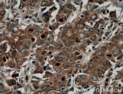 KRAS-2B Rabbit anti-Human, Mouse, Polyclonal, Proteintech 150 &mu;L; Unconjugated:Antibodies,