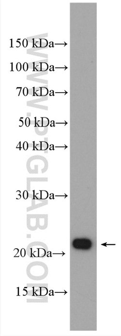 KRAS-2B Rabbit anti-Human, Mouse, Polyclonal, Proteintech 150 &mu;L; Unconjugated:Antibodies,