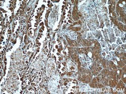 HDAC4 Rabbit anti-Human, Mouse, Rat, Polyclonal, Proteintech:Antibodies:Primary