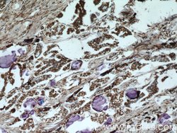 HDAC4 Rabbit anti-Human, Mouse, Rat, Polyclonal, Proteintech:Antibodies:Primary