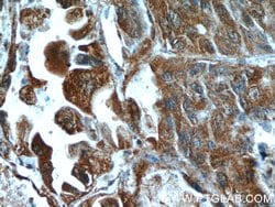 HDAC4 Rabbit anti-Human, Mouse, Rat, Polyclonal, Proteintech:Antibodies:Primary