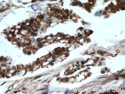 HDAC4 Rabbit anti-Human, Mouse, Rat, Polyclonal, Proteintech:Antibodies:Primary