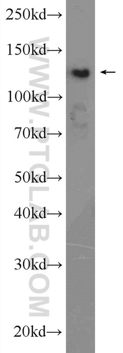 HDAC4 Rabbit anti-Human, Mouse, Rat, Polyclonal, Proteintech:Antibodies:Primary