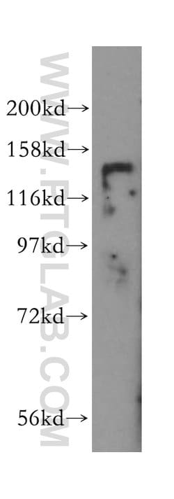 HDAC4 Rabbit anti-Human, Mouse, Rat, Polyclonal, Proteintech:Antibodies:Primary
