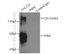 Palladin Rabbit anti-Human, Polyclonal, Proteintech:Antibodies:Primary