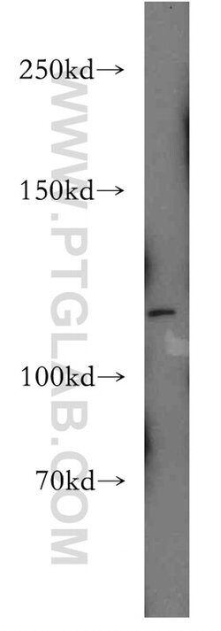 Palladin Rabbit anti-Human, Polyclonal, Proteintech:Antibodies:Primary