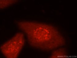 MYPN Rabbit anti-Human, Polyclonal, Proteintech 150 &mu;L; Unconjugated:Antibodies,