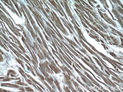 MYPN Rabbit anti-Human, Polyclonal, Proteintech 150 &mu;L; Unconjugated:Antibodies,