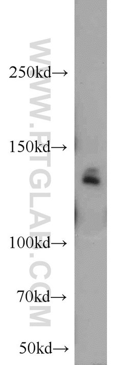 MYPN Rabbit anti-Human, Polyclonal, Proteintech 150 &mu;L; Unconjugated:Antibodies,