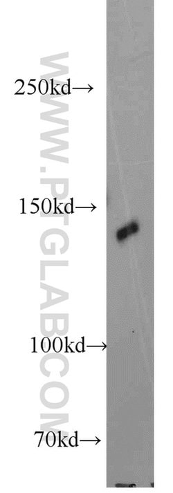 MYPN Rabbit anti-Human, Polyclonal, Proteintech 150 &mu;L; Unconjugated:Antibodies,