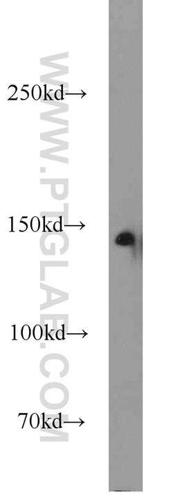 MYPN Rabbit anti-Human, Polyclonal, Proteintech 150 &mu;L; Unconjugated:Antibodies,